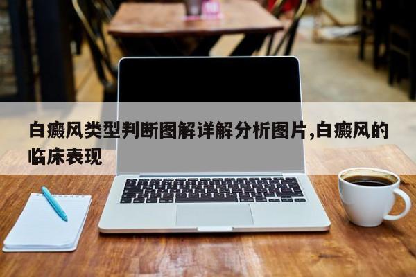白癜风类型判断图解详解分析图片,白癜风的临床表现