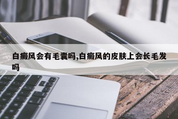 白癜风会有毛囊吗,白癜风的皮肤上会长毛发吗